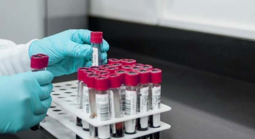 Mañana viernes comenzará la jornada de extracción de sangre en Pav